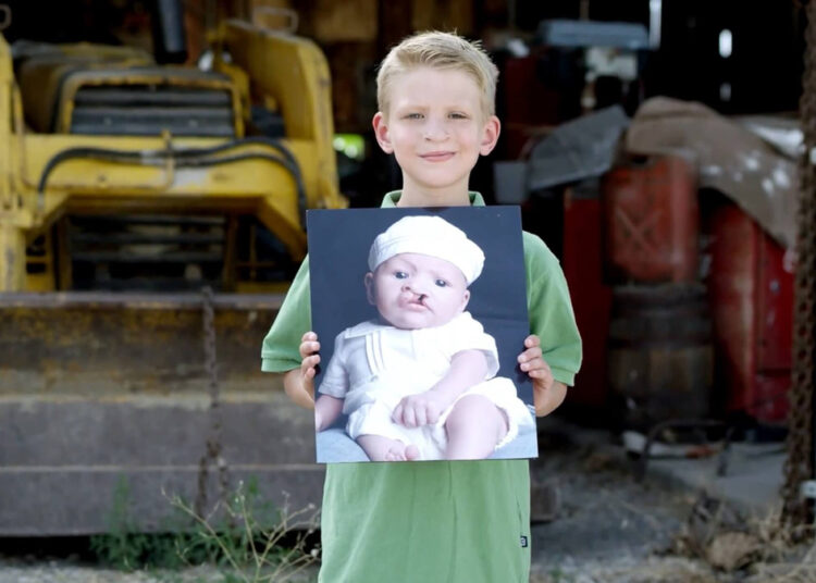 Од естетике до еугенике – абортус чак и због расцепа усне