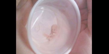 ПРЕНОСИМО: ЖИВОТ ПОЧИЊЕ ЗАЧЕЋЕМ