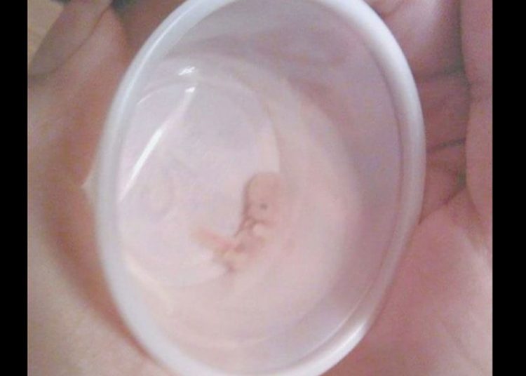 ПРЕНОСИМО: ЖИВОТ ПОЧИЊЕ ЗАЧЕЋЕМ