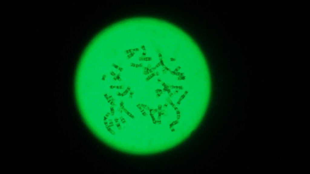 Cromosomi umani al visti al microscopio