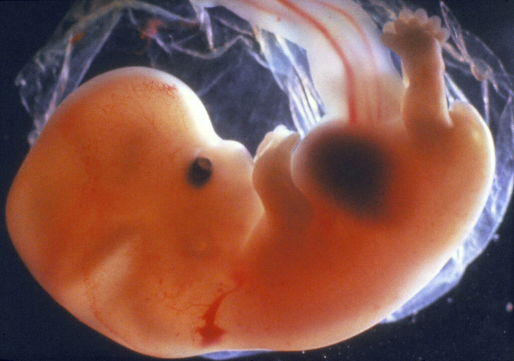 embrione umano di circa sette settimane