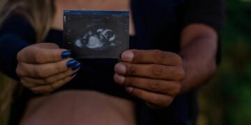Famiglia, ecografia bimbo (Pixabay)