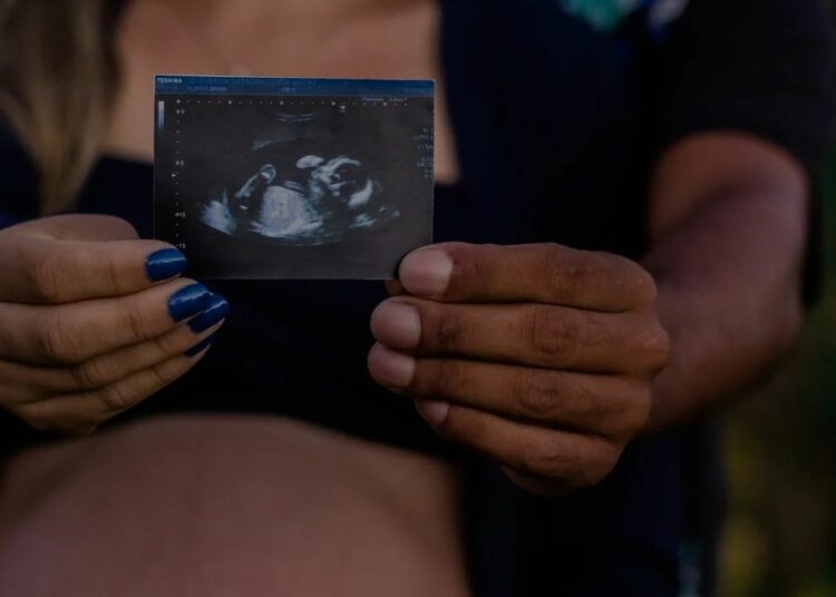 Famiglia, ecografia bimbo (Pixabay)