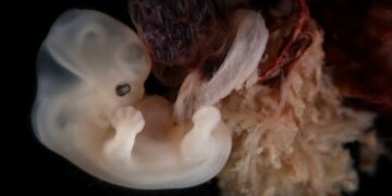 Leopoldina fordert erneut laxeren Embryonenschutz – Bürger können online mitdiskutieren