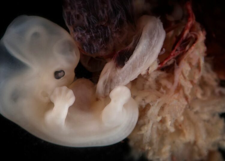 Leopoldina fordert erneut laxeren Embryonenschutz – Bürger können online mitdiskutieren