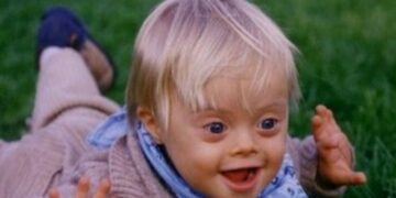 Bambino con sindrome di Down