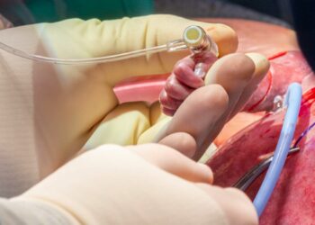 Medizinischer Durchbruch: Ärzte retten Kind durch seltene Operation am fötalen Herzen