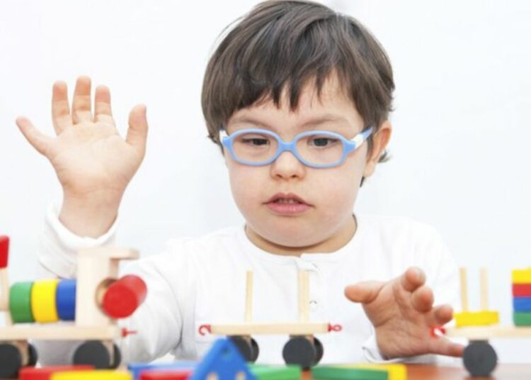 Bambino sindrome di Down