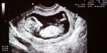 Pourquoi la décision de la Cour suprême pourrait provoquer un conflit sans précédent aux États-Unis ? (Analyse très personnelle)