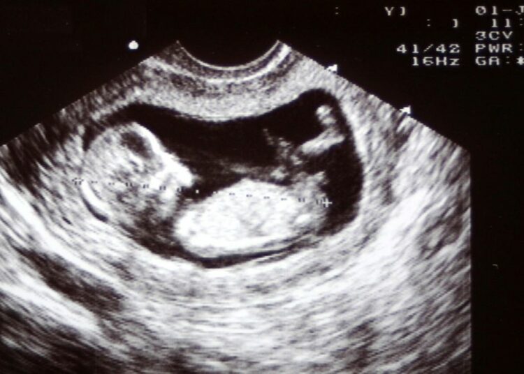 Pourquoi la décision de la Cour suprême pourrait provoquer un conflit sans précédent aux États-Unis ? (Analyse très personnelle)