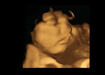 Neue Studie: Kinder verschmähen Kohl schon im Mutterleib, mögen Karotten