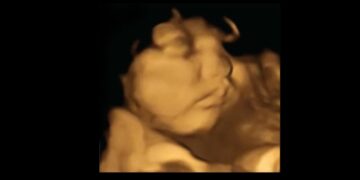 Neue Studie: Kinder verschmähen Kohl schon im Mutterleib, mögen Karotten