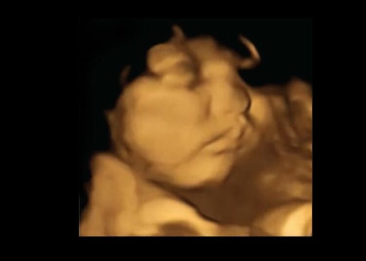 Neue Studie: Kinder verschmähen Kohl schon im Mutterleib, mögen Karotten