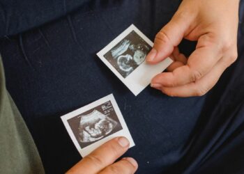 ПОДРШКА УРЕДБИ О „ОТКУЦАЈУ СРЦА“ У МАЂАРСКОЈ