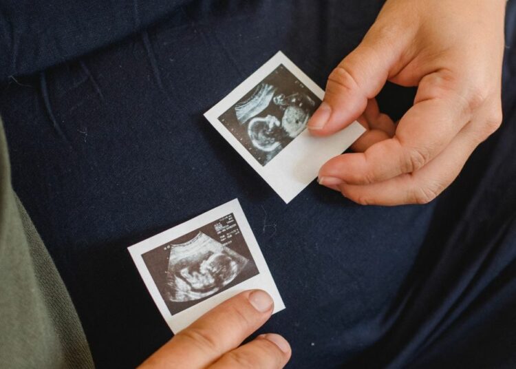 ПОДРШКА УРЕДБИ О „ОТКУЦАЈУ СРЦА“ У МАЂАРСКОЈ