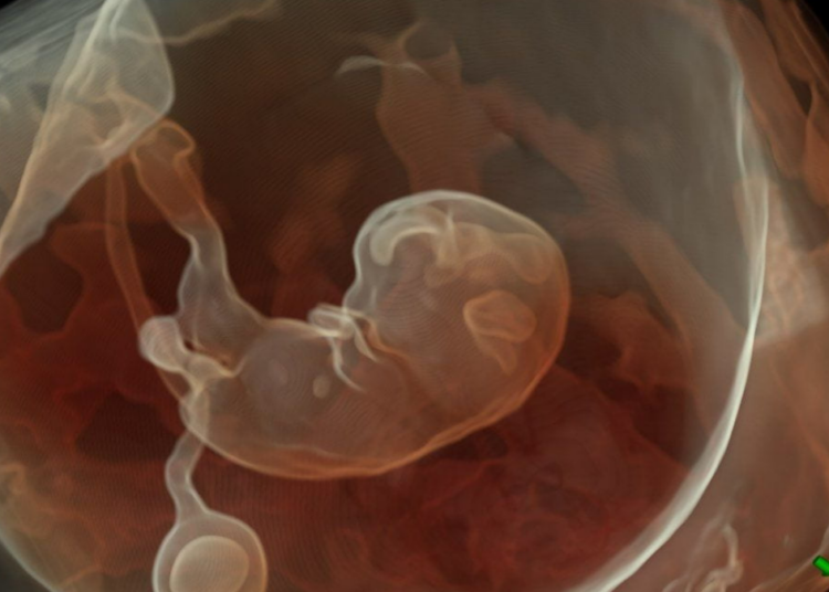 Je veux entendre les battements du coeur du foetus !