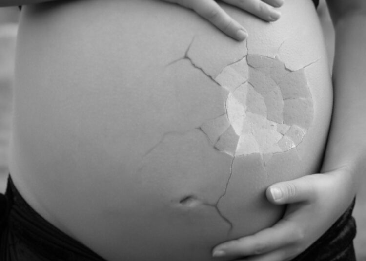 Un uomo fa causa alla donna che ha abortito per l’uccisione illegale di suo figlio