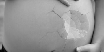 USA: Umstrittener Gesetzentwurf zur Legalisierung von Spätabtreibungen bis zur Geburt in Maine verabschiedet