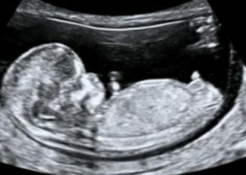 Se aprueba en Maine un proyecto de ley que legaliza los abortos tardíos hasta el nacimiento