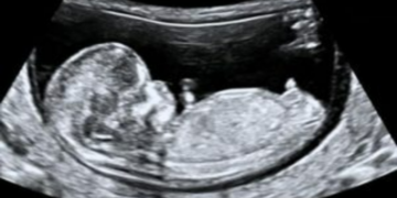 Se aprueba en Maine un proyecto de ley que legaliza los abortos tardíos hasta el nacimiento