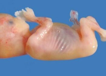 Des bébés morts transformés en “médicament”