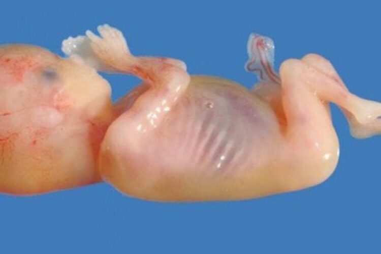 Des bébés morts transformés en “médicament”