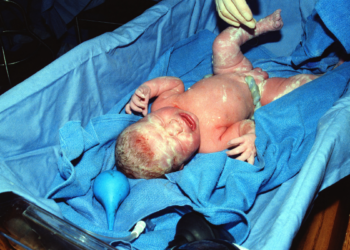 Aumentan los abortos mientras sus defensores piden que se aborte hasta el nacimiento