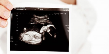 La administración Trump elogiada por recortar fondos a la investigación con bebés abortados