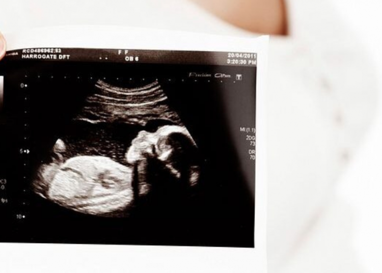 La administración Trump elogiada por recortar fondos a la investigación con bebés abortados