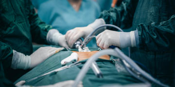 La revisione dell’HRSA rivela il prelievo di organi prima della fine della vita